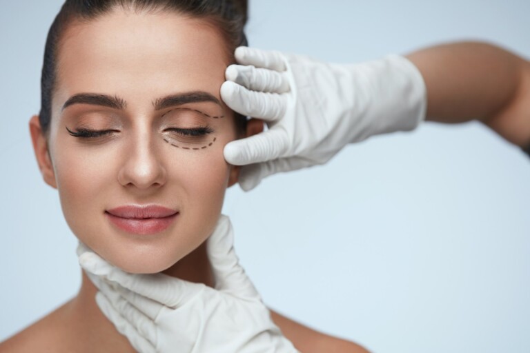 blepharoplasty-surgery