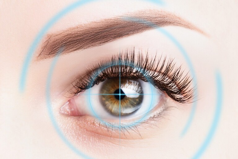laser eye sugery